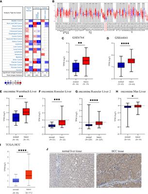 EOGT Correlated With Immune Infiltration: A Candidate Prognostic Biomarker for Hepatocellular Carcinoma